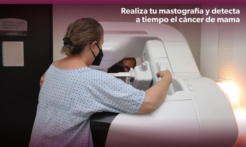 Mastografía