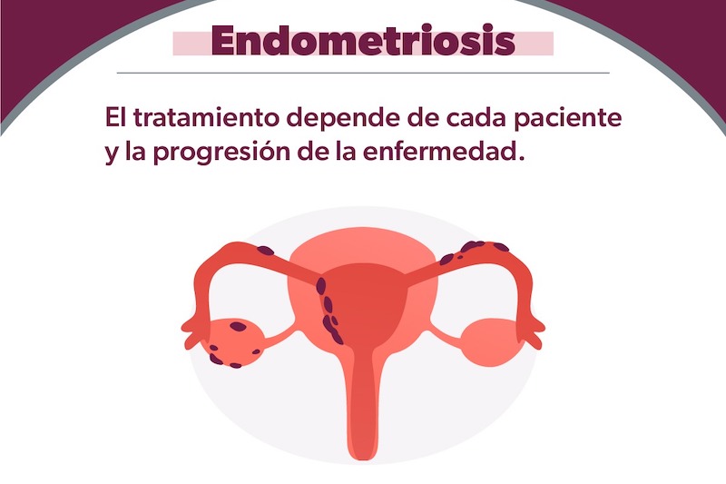 Endometriosis
