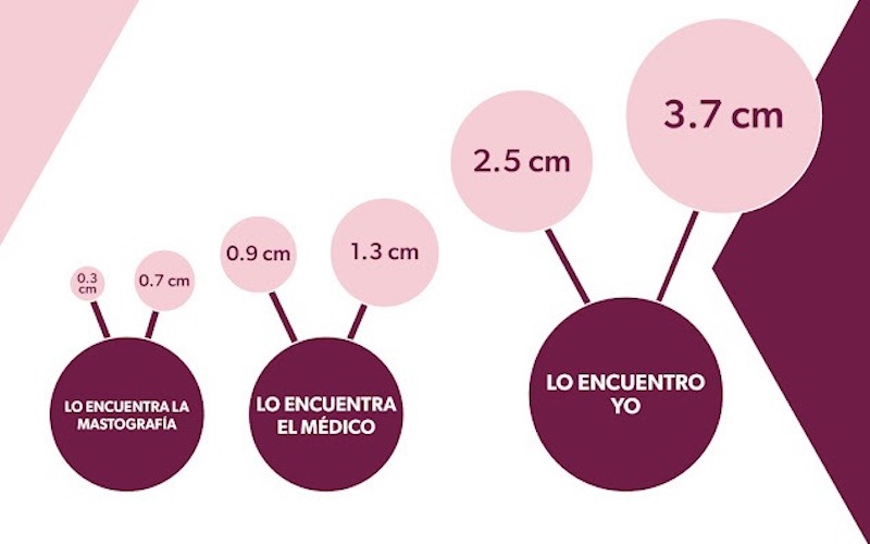Mastografías gratuitas