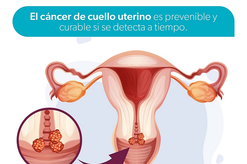 VPH, SSM Michoacán