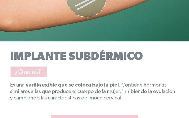 SSM Michoacán