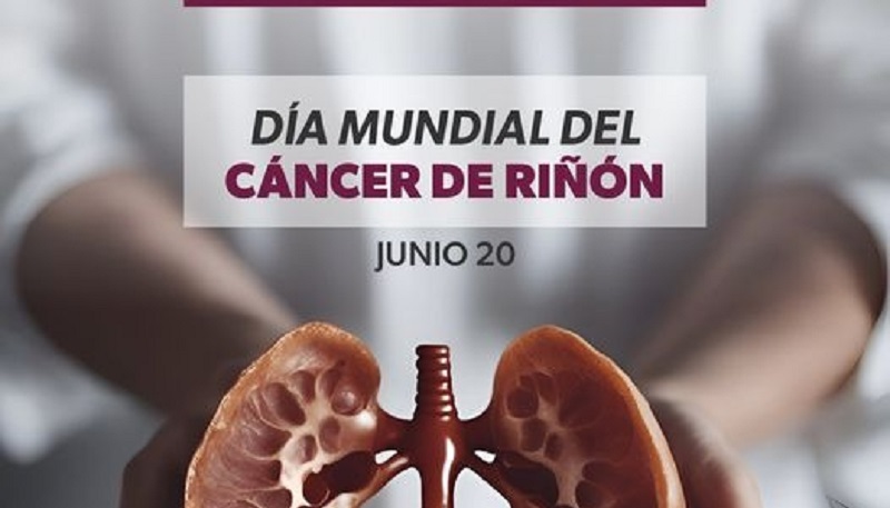 Cáncer de Riñón, SSM Michoacán