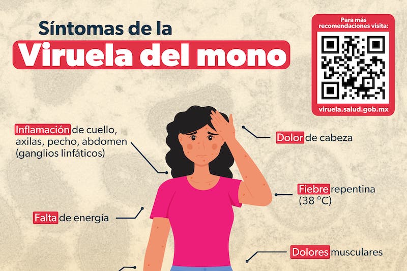 Viruela del mono