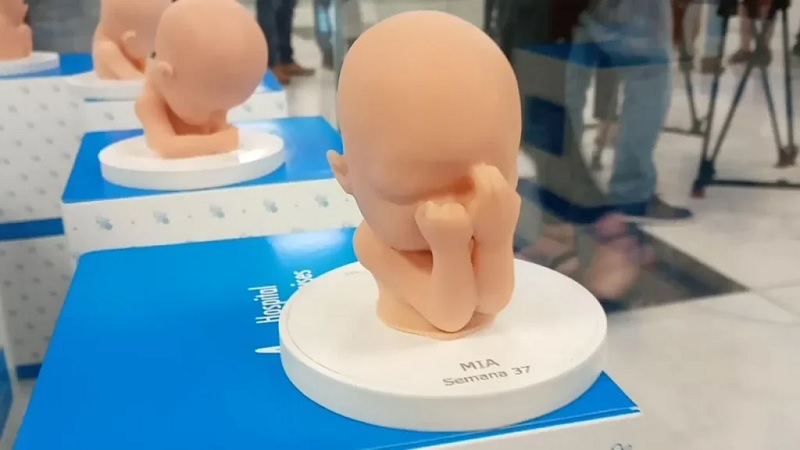 dolor fetal