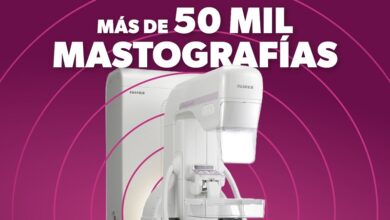 SSM, Mastografías, Prevención