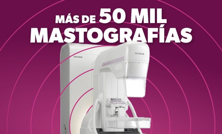 SSM, Mastografías, Prevención